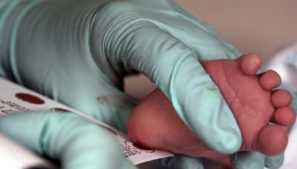 screening fenilcetunorie
